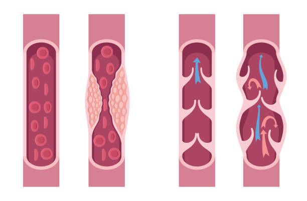 Used cigarette symbolizing quitting